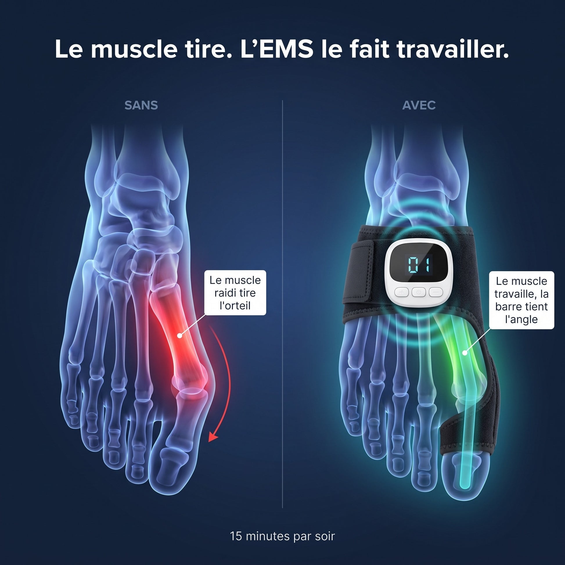 Le muscle tire, l'EMS le fait travailler — illustration du mécanisme